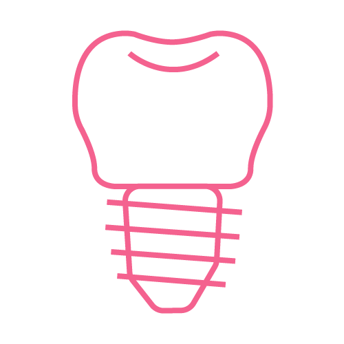 Implantes dentales<br>
