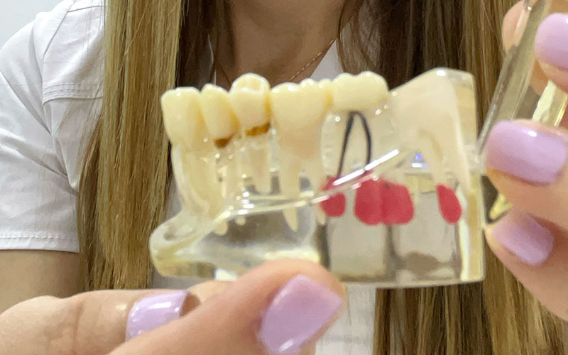 endodoncia
